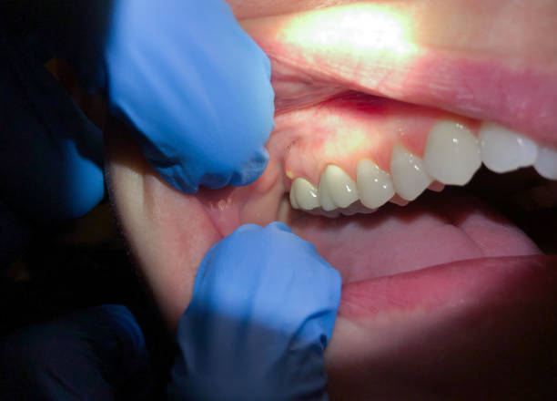 Best Emergency Orthodontic Services in Vaville, CA