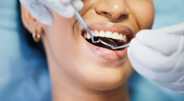 Best Cosmetic Emergency Dentistry in Vaville, CA