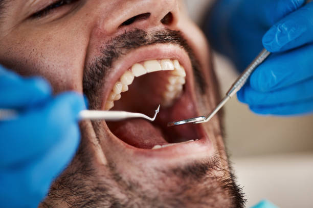 Best Emergency Dental Care for Broken or Chipped Teeth in Vaville, CA